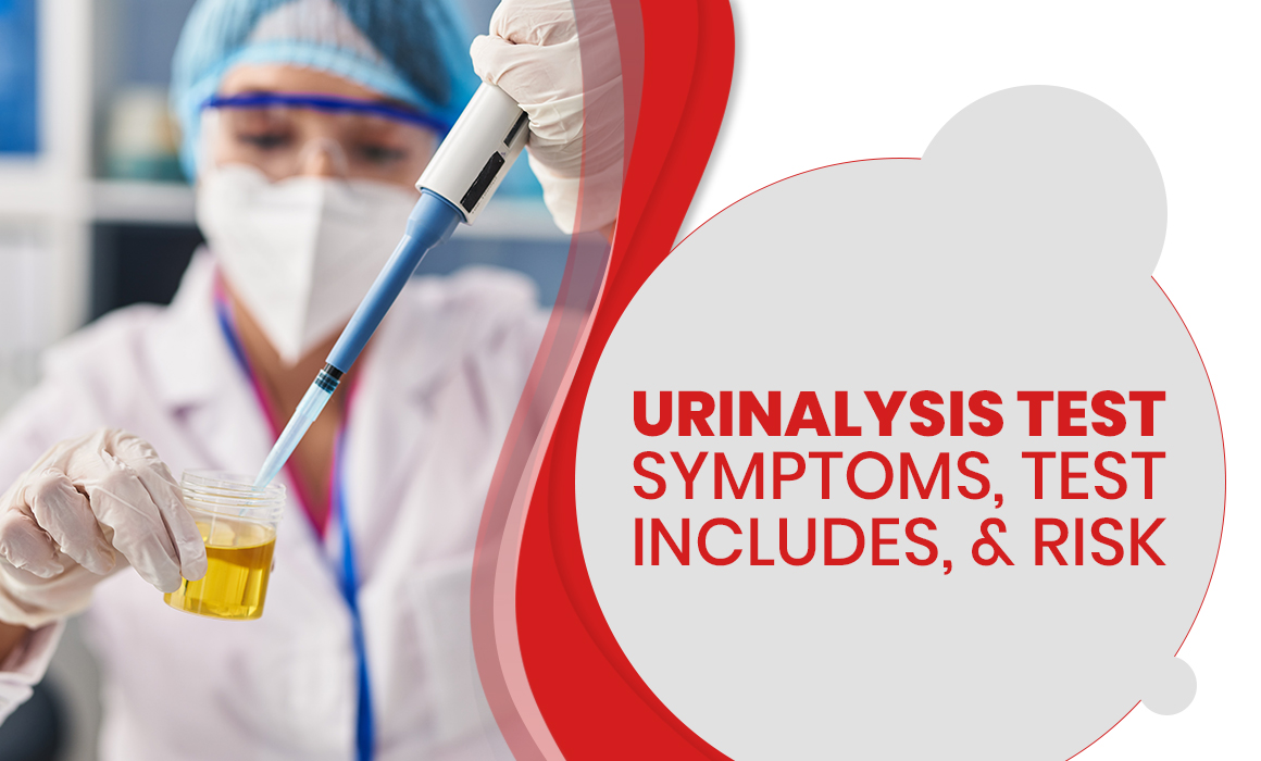 Urinalysis Test Symptoms, Test Includes, Risks & Test Results